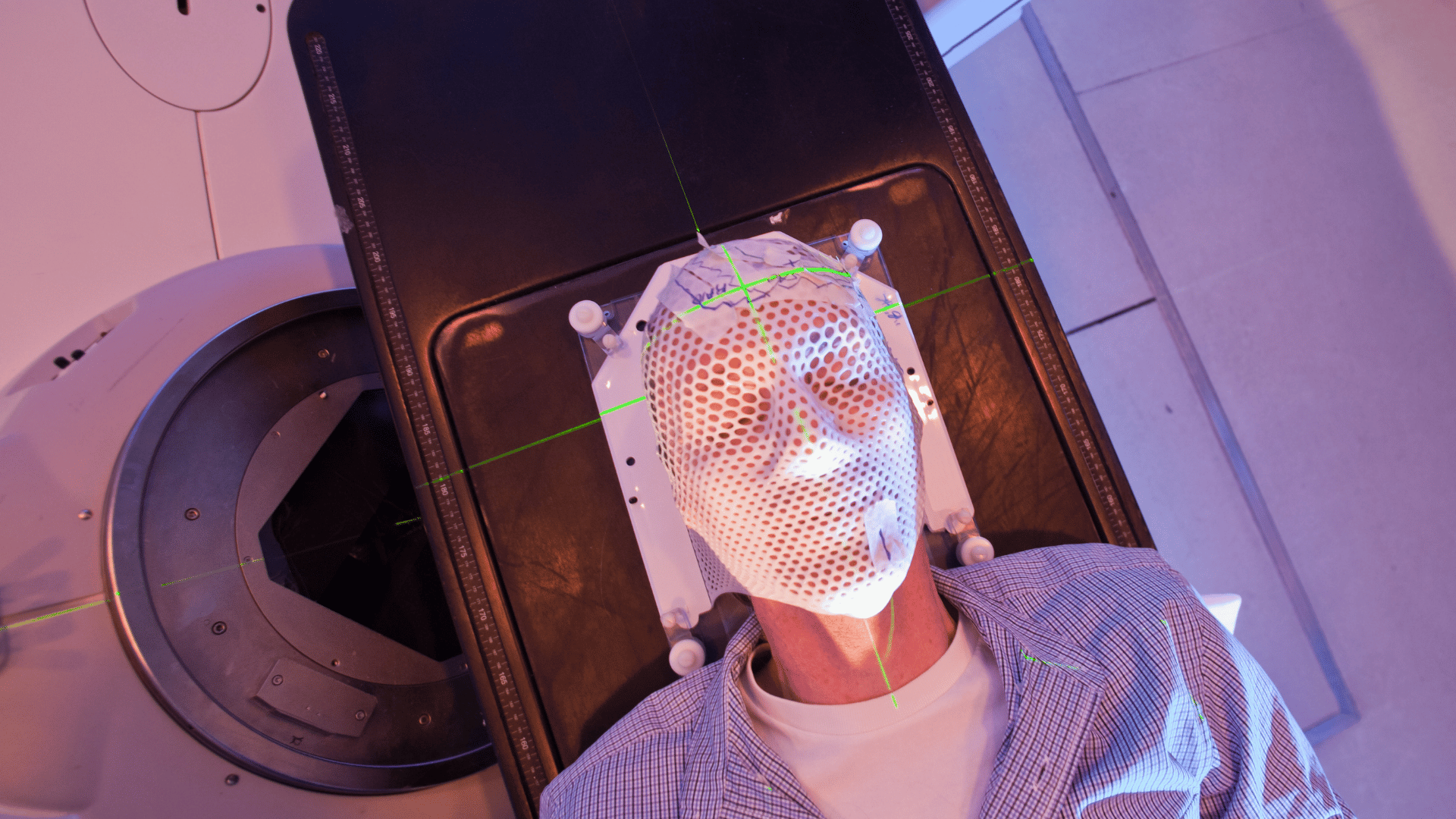 Perforated vs. Solid, 2.4 mm vs. 3.2 mm: